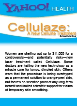 Cellulaze FDA approval announcement from Yahoo Health featuring laser cellulite treatment information