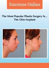 Chin implant before and after comparison showing profile transformation from plastic surgery procedure