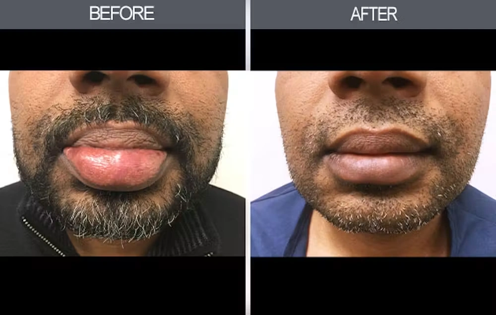 Real patient results in New York, NY Performed by Darrick E. Antell MD, FACS
