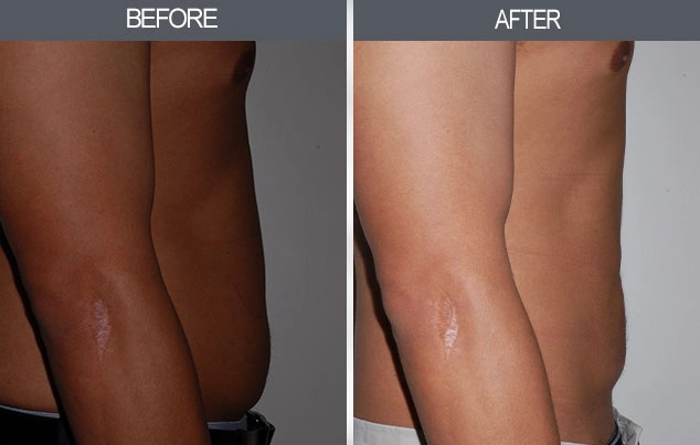 Real patient results in New York, NY Performed by Darrick E. Antell MD, FACS