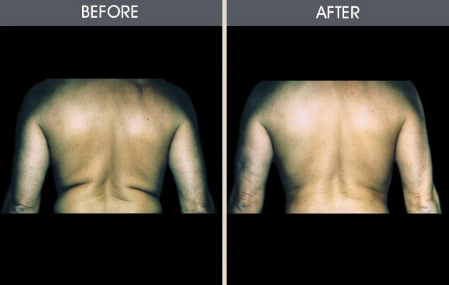 Real patient results in New York, NY Performed by Darrick E. Antell MD, FACS