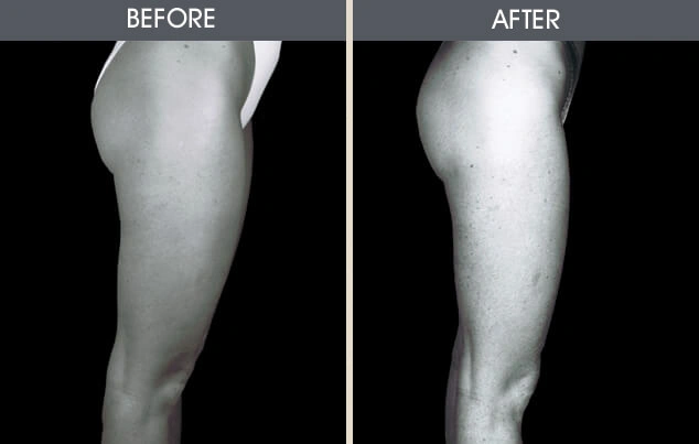 Real patient results in New York, NY Performed by Darrick E. Antell MD, FACS