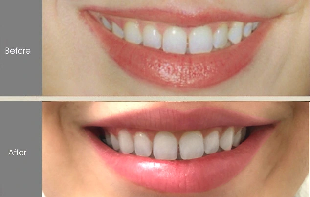 Real patient results in New York, NY Performed by Darrick E. Antell MD, FACS