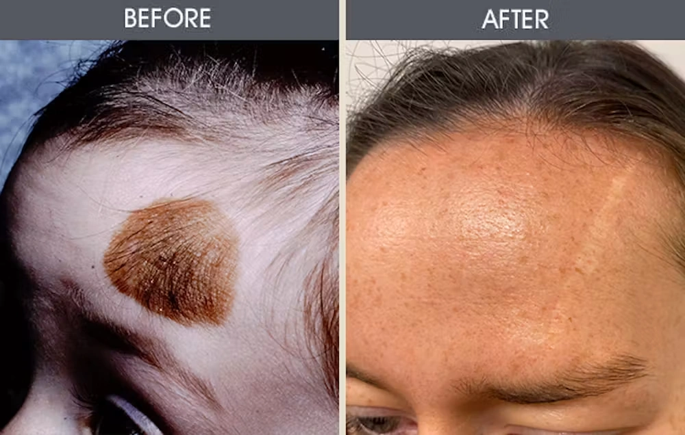 Real patient results in New York, NY Performed by Darrick E. Antell MD, FACS