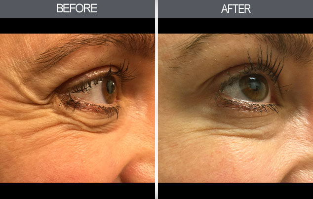 Real patient results in New York, NY Performed by Darrick E. Antell MD, FACS