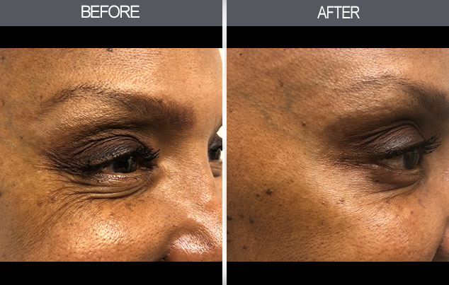 Real patient results in New York, NY Performed by Darrick E. Antell MD, FACS