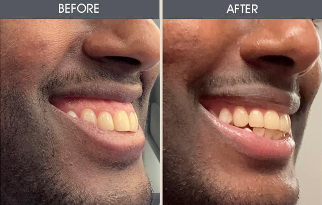 Real patient results in New York, NY Performed by Darrick E. Antell MD, FACS