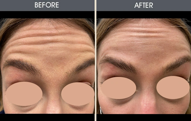 Real patient results in New York, NY Performed by Darrick E. Antell MD, FACS