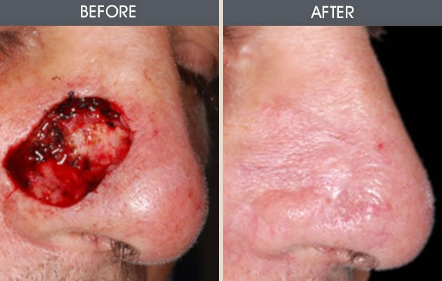 Real patient results in New York, NY Performed by Darrick E. Antell MD, FACS