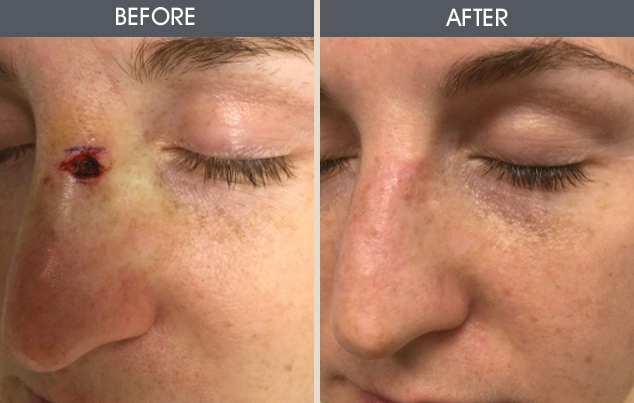 Real patient results in New York, NY Performed by Darrick E. Antell MD, FACS