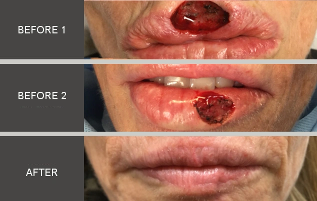 Real patient results in New York, NY Performed by Darrick E. Antell MD, FACS