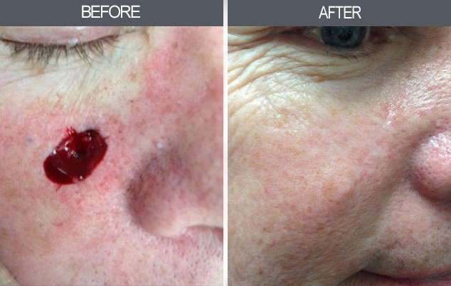 Real patient results in New York, NY Performed by Darrick E. Antell MD, FACS