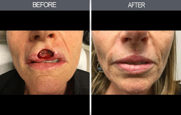Real patient results in New York, NY Performed by Darrick E. Antell MD, FACS