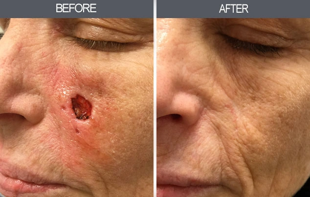 Real patient results in New York, NY Performed by Darrick E. Antell MD, FACS