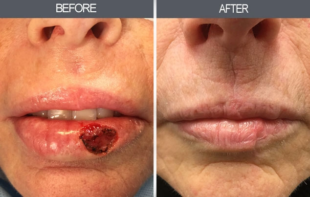 Real patient results in New York, NY Performed by Darrick E. Antell MD, FACS