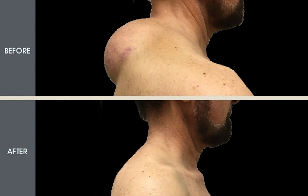 Real patient results in New York, NY Performed by Darrick E. Antell MD, FACS