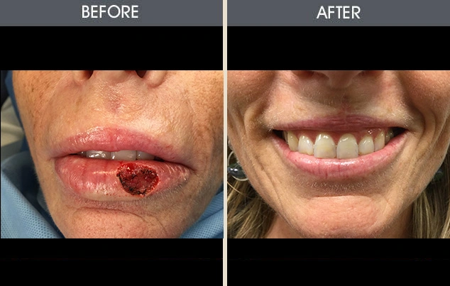 Real patient results in New York, NY Performed by Darrick E. Antell MD, FACS