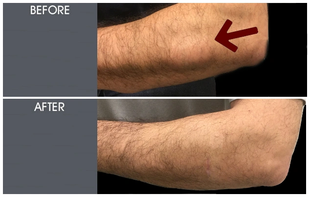 Real patient results in New York, NY Performed by Darrick E. Antell MD, FACS