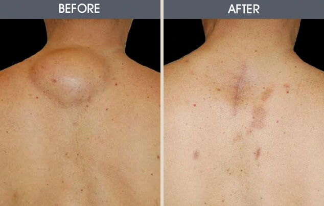 Real patient results in New York, NY Performed by Darrick E. Antell MD, FACS