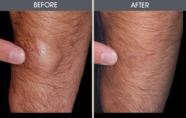 Real patient results in New York, NY Performed by Darrick E. Antell MD, FACS