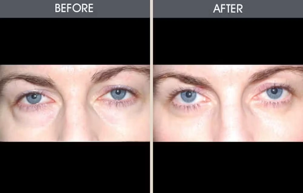 Real patient results in New York, NY Performed by Darrick E. Antell MD, FACS