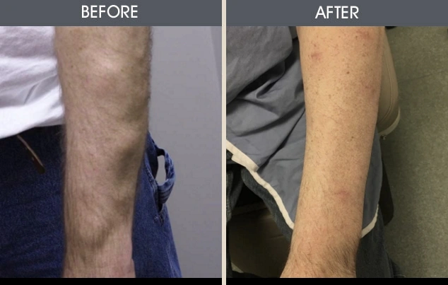 Real patient results in New York, NY Performed by Darrick E. Antell MD, FACS