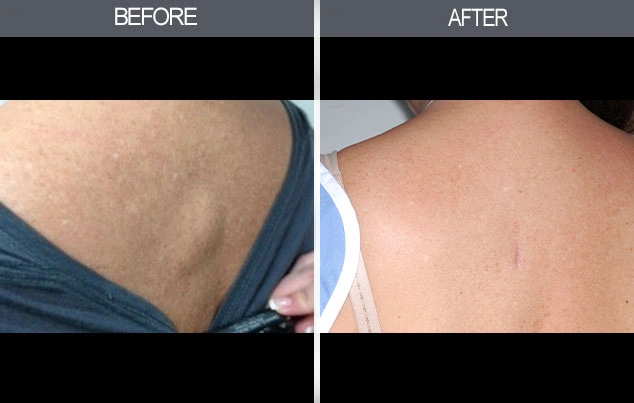Real patient results in New York, NY Performed by Darrick E. Antell MD, FACS