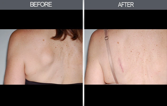 Real patient results in New York, NY Performed by Darrick E. Antell MD, FACS