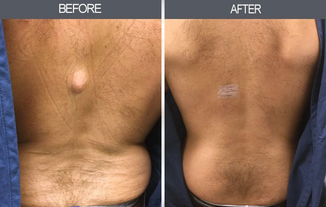 Real patient results in New York, NY Performed by Darrick E. Antell MD, FACS