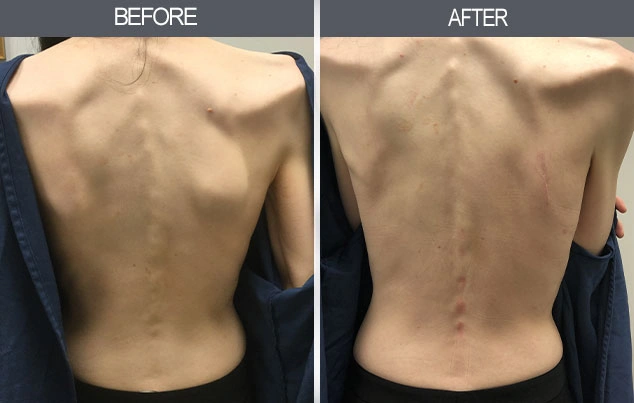 Real patient results in New York, NY Performed by Darrick E. Antell MD, FACS