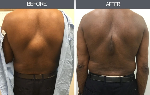 Real patient results in New York, NY Performed by Darrick E. Antell MD, FACS