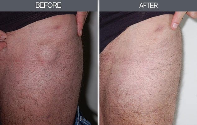 Real patient results in New York, NY Performed by Darrick E. Antell MD, FACS