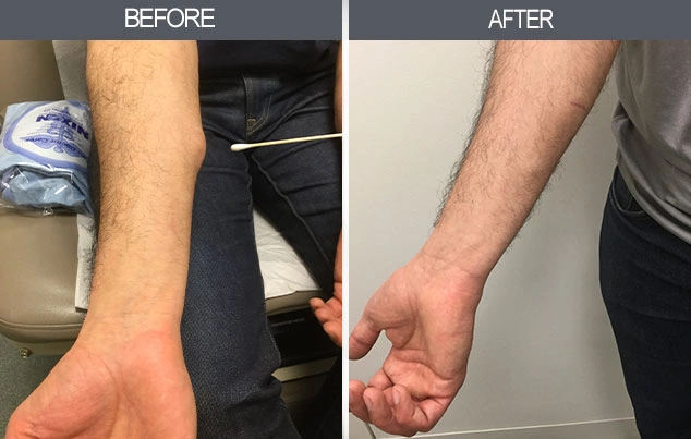 Real patient results in New York, NY Performed by Darrick E. Antell MD, FACS