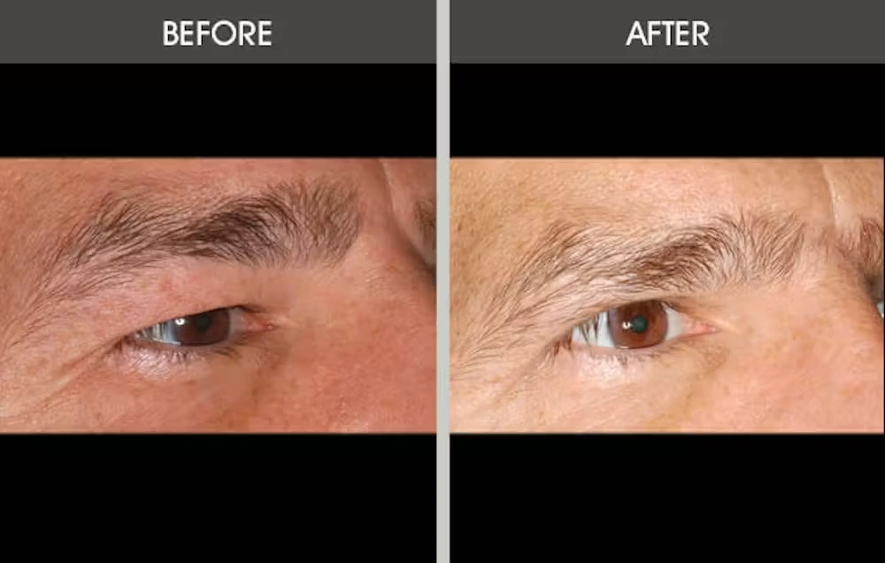 Real patient results in New York, NY Performed by Darrick E. Antell MD, FACS