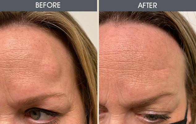 Real patient results in New York, NY Performed by Darrick E. Antell MD, FACS