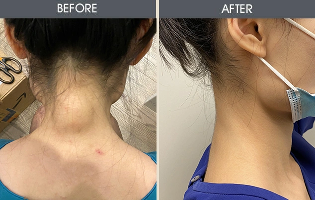 Real patient results in New York, NY Performed by Darrick E. Antell MD, FACS