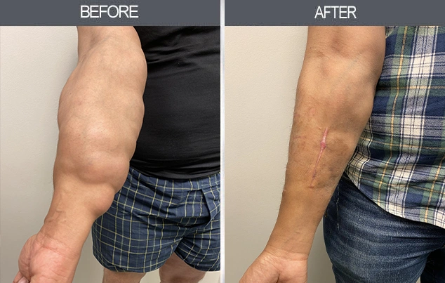 Real patient results in New York, NY Performed by Darrick E. Antell MD, FACS