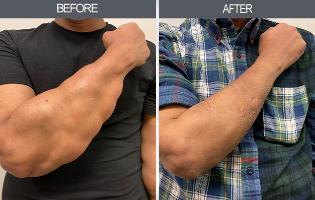 Real patient results in New York, NY Performed by Darrick E. Antell MD, FACS