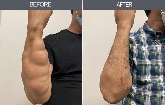 Real patient results in New York, NY Performed by Darrick E. Antell MD, FACS