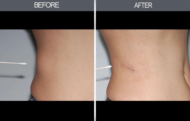 Real patient results in New York, NY Performed by Darrick E. Antell MD, FACS