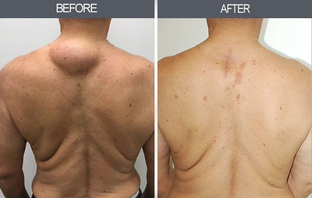 Real patient results in New York, NY Performed by Darrick E. Antell MD, FACS