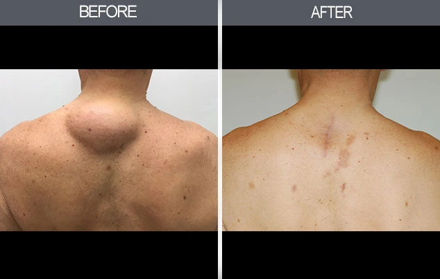 Real patient results in New York, NY Performed by Darrick E. Antell MD, FACS