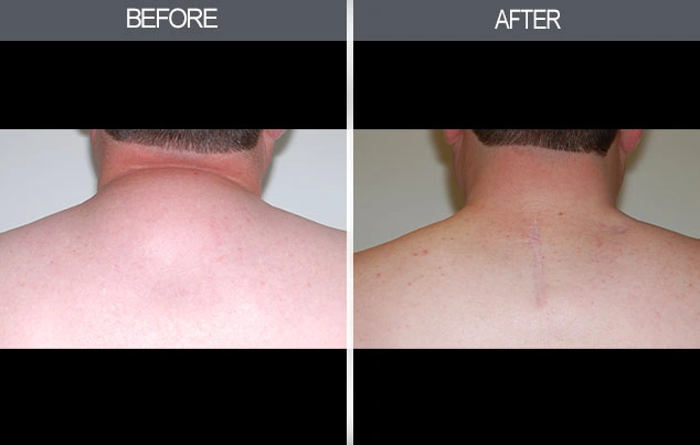 Real patient results in New York, NY Performed by Darrick E. Antell MD, FACS