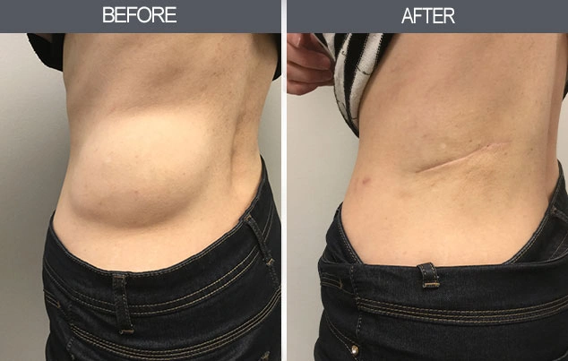 Real patient results in New York, NY Performed by Darrick E. Antell MD, FACS