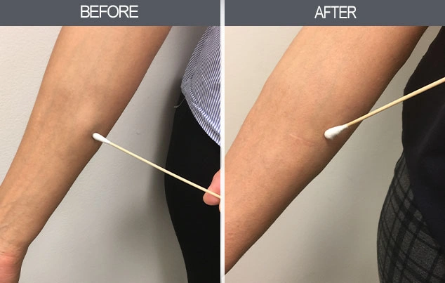 Real patient results in New York, NY Performed by Darrick E. Antell MD, FACS