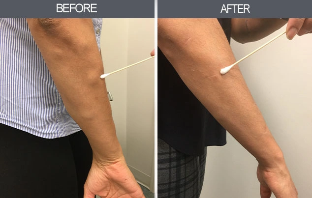 Real patient results in New York, NY Performed by Darrick E. Antell MD, FACS