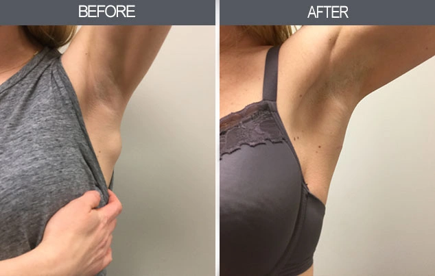 Real patient results in New York, NY Performed by Darrick E. Antell MD, FACS
