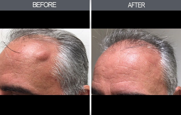 Real patient results in New York, NY Performed by Darrick E. Antell MD, FACS