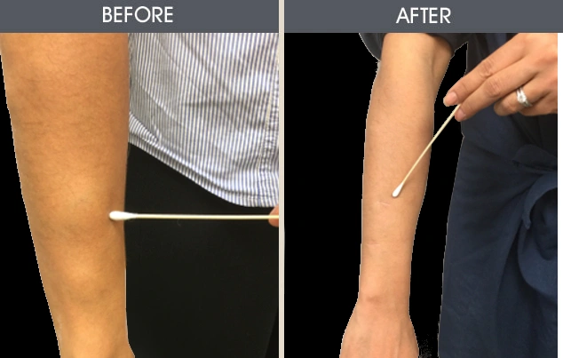 Real patient results in New York, NY Performed by Darrick E. Antell MD, FACS