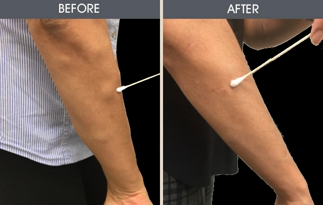Real patient results in New York, NY Performed by Darrick E. Antell MD, FACS